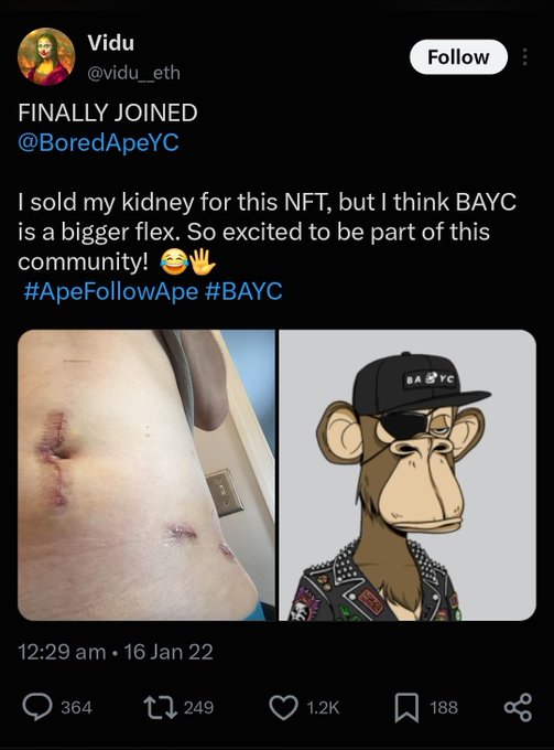 A tweet from @vidu_eth titled 'FINALLY JOINED @BoredApeYC' with text joking 'I sold my kidney for this NFT,' alongside photos of surgical scars and a Bored Ape Yacht Club NFT character.