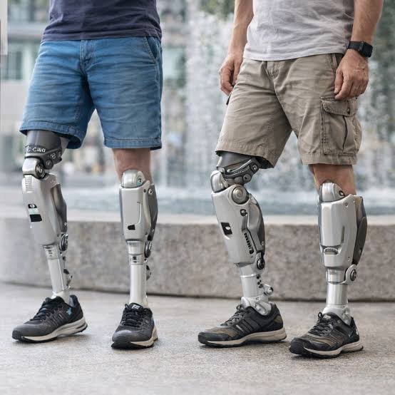 A close-up photo showing two people wearing advanced robotic prosthetic legs standing outdoors on a paved surface.
