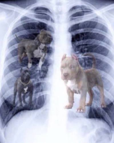 A digitally altered chest X-ray shows three dogs (a pit bull, a small black puppy, and a brindle dog) "living" inside the lungs, humorously illustrating the slang expression "got that dawg in me" by depicting actual dogs residing within the chest cavity.