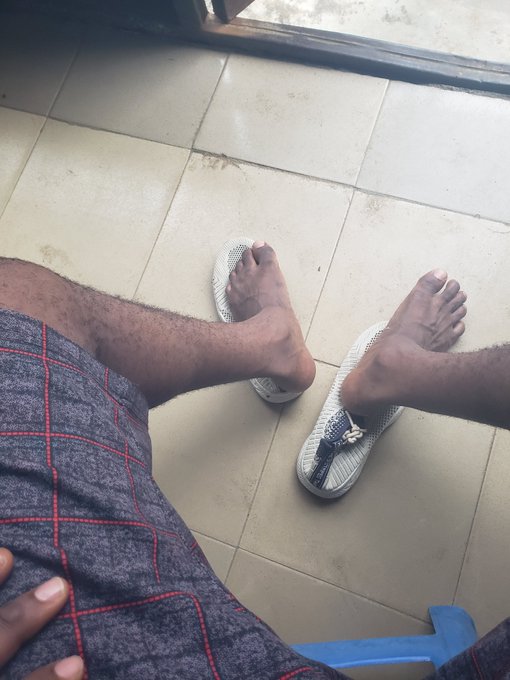 A first-person view of a person's legs and feet, wearing white flip-flop sandals and plaid shorts, sitting on a chair on a tiled floor.