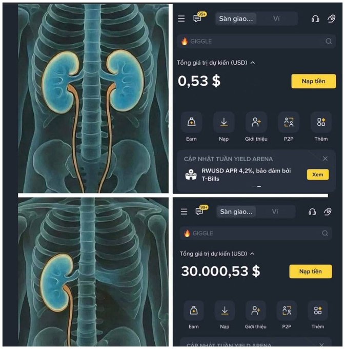 The image shows two different views of an X-ray of a person's rib cage with the text "Just raised a little USDT, bros, mind sharing which code's hot to scoop up?" The first view is from the left side of the screen and has a blue background, while the second view is on the right side. Both images have the same content in terms of the rib cage and the text related to raising funds for a charity or cause. The image does not provide any information about the currency used or the specific charity being supported.