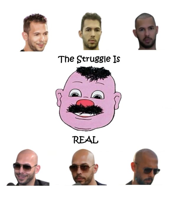 A meme featuring six photos of soccer player Sergio Agüero showing his hair loss progression, with a cartoon pink face in the center and the text 'The Struggle Is REAL'.
