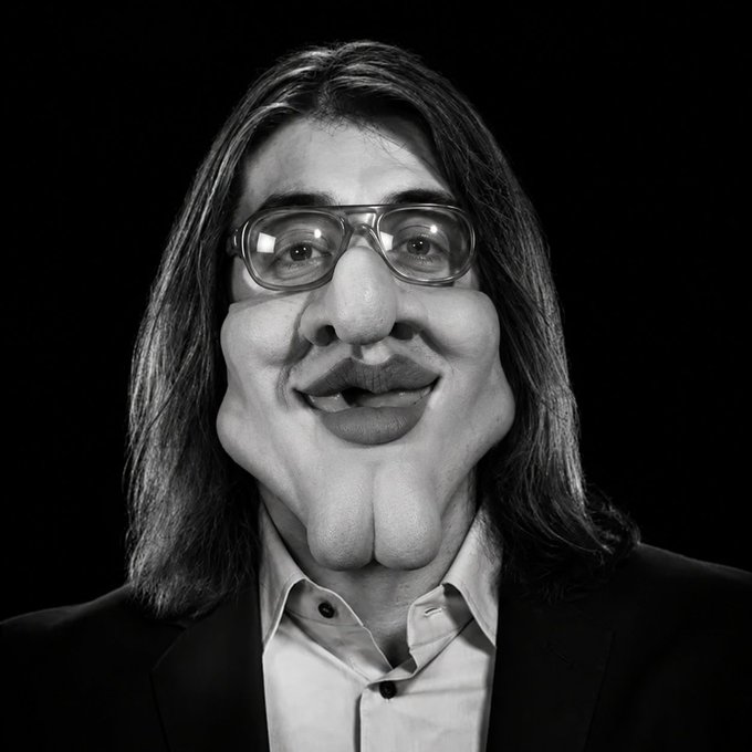 A black and white distorted photograph showing a person with long dark hair, large glasses, and exaggerated facial features.