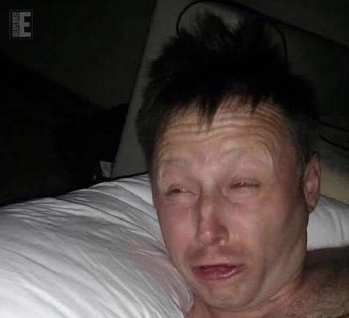 A photo of a disheveled person with messy dark hair lying on a white pillow, appearing tearful, with a 'Source F' watermark in the corner.