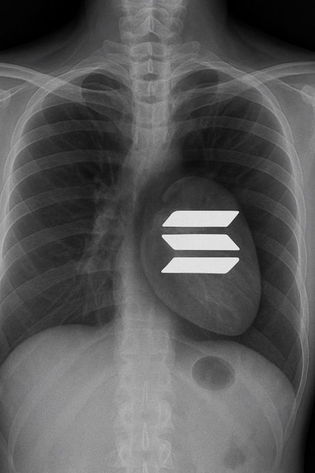 A black and white chest X-ray image featuring a white logo of three stacked horizontal bars.