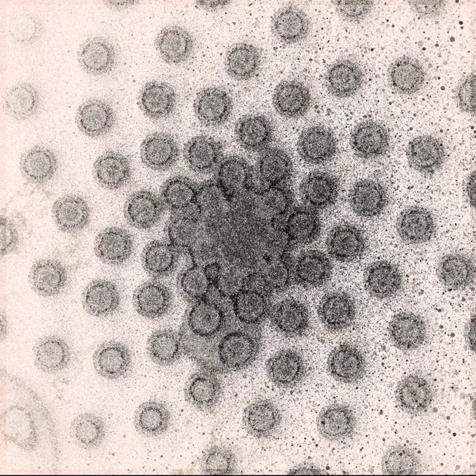 A black and white electron microscope image showing a cluster of small, circular virus particles grouped together in the center with scattered particles throughout the background.