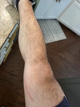 A selfie showing a person's leg with a fresh red scratch/scar on the knee, taken in a home setting with hardwood floors and a tiled entryway visible.