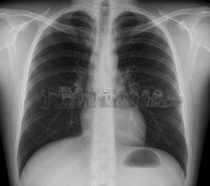 A creative chest X-ray featuring a line of miniature fictional characters (from games and movies) standing along the horizontal center of the ribcage.