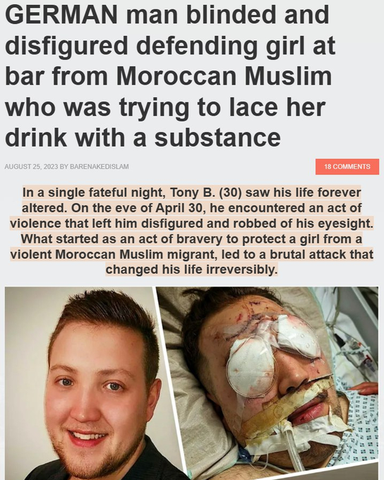 The image shows a news article headline from BarenakedIslam (dated August 25, 2023) titled "GERMAN man blinded and disfigured defending girl at bar from Moroccan Muslim who was trying to lace her drink with a substance," accompanied by before-and-after photos of the victim, Tony B., and a photo of his injuries. The accompanying post's sentiment about "the same story repeating itself" appears to frame this incident as part of a perceived recurring pattern of violent crime allegedly committed by Muslim migrants in Germany.