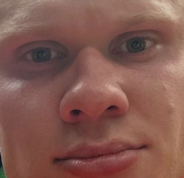 Close-up photo of a fair-haired man with a bruised, swollen, and reddened face, paired with the caption "Saylors selling" to humorously suggest that the selling pressure from Saylor (likely referring to Michael Saylor of MicroStrategy) is leaving him battered and beat up.