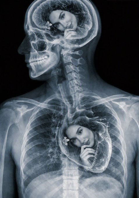 A surreal digital composite image showing an X-ray view of a human upper body, with two women resting inside the brain and heart cavities.