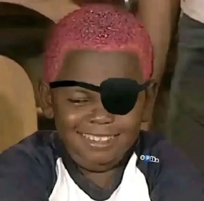 A young boy wearing a pink crocheted cap and an eyepatch smiles broadly, showing his teeth.