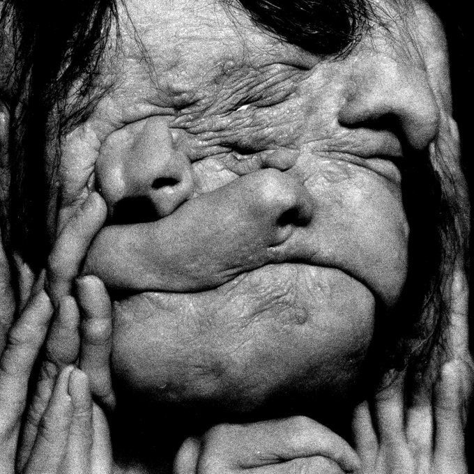 A black-and-white surreal artistic portrait showing a person's face with multiple overlapping features, eyes closed, and hands pulling at the skin, creating a distorted, multi-layered effect.