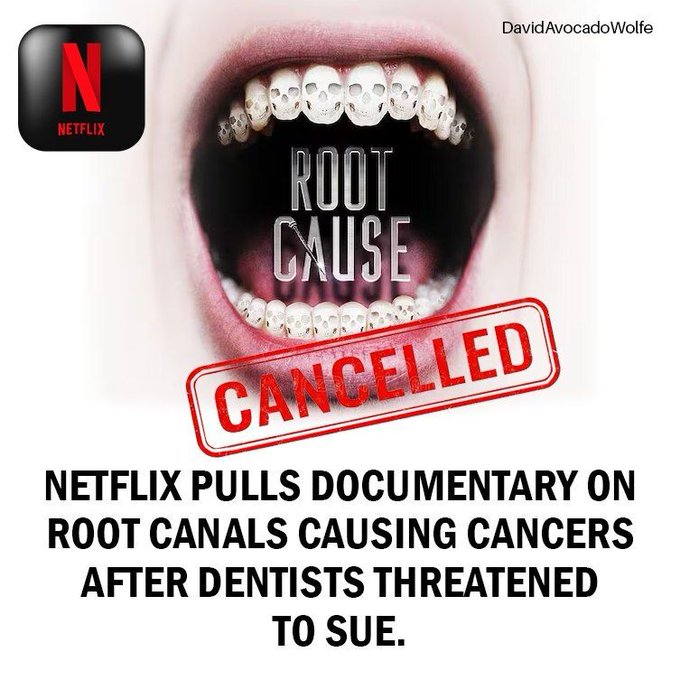 A graphic by DavidAvocadoWolfe showing an open mouth with skull-patterned teeth, overlaid with the text 'ROOT CAUSE', a red 'CANCELLED' stamp, a Netflix logo, and the caption 'NETFLIX PULLS DOCUMENTARY ON ROOT CANALS CAUSING CANCERS AFTER DENTISTS THREATENED TO SUE.'