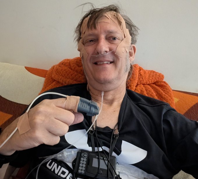 A smiling man with medical tape on his face holding a pulse oximeter on his finger, with a nasal cannula and medical equipment attached, wearing a black shirt.