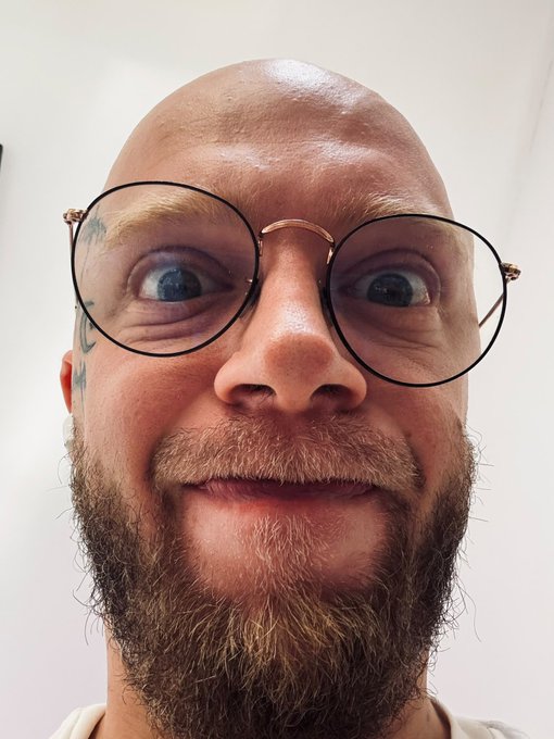 A wide-eyed, bearded man stares intensely through oversized round glasses, his crossed eyes and tense expression perfectly capturing the frazzled, chart-weary desperation hinted at in the post about needing to step away from trading screens.