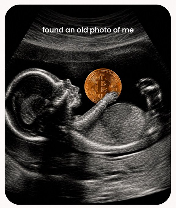 A black-and-white ultrasound image shows a fetus appearing to hold a physical Bitcoin coin, with the text "found an old photo of me" overlaid at the top, humorously illustrating the "early" crypto investing joke—suggesting the person has been into Bitcoin since before birth.