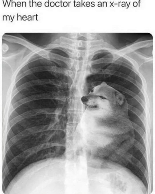 A meme with the text 'When the doctor takes an x-ray of my heart' shows a chest x-ray where a Shiba Inu dog's face is visible in place of the heart.