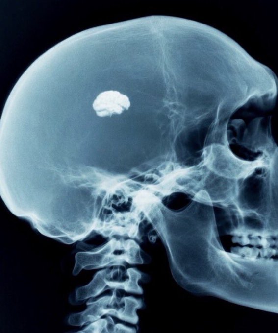 The image shows a skull with an object, possibly a brain or a small piece of food, placed over its head. The object appears to be a brain-shaped item that resembles a coin. The background of the image is black, which contrasts with the white skull and makes it stand out more prominently. The post also mentions "solana summer", but there doesn't seem to be any direct connection between the image and this phrase.