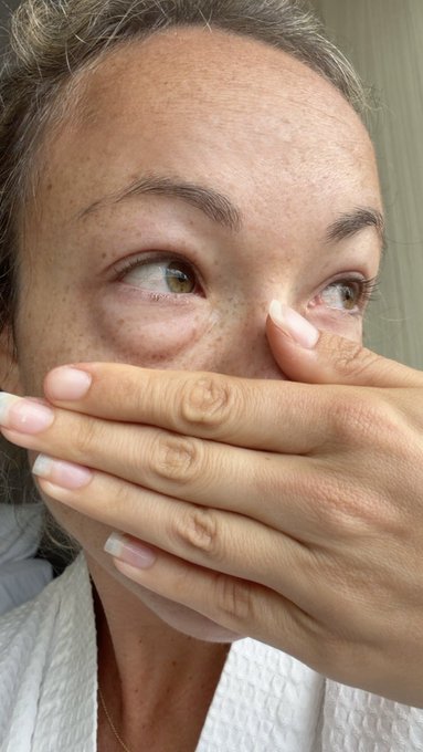 A close-up selfie of a woman with freckles covering her mouth with her hand while looking upward with a surprised or contemplative expression.