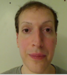 A close-up selfie of a man with flushed red cheeks and visible under-eye circles, paired with the caption "Pumpfun is going to ZERO — Newsy Johnson." The image appears unrelated to the bearish crypto statement, serving solely as a headshot of the author predicting the token's decline.