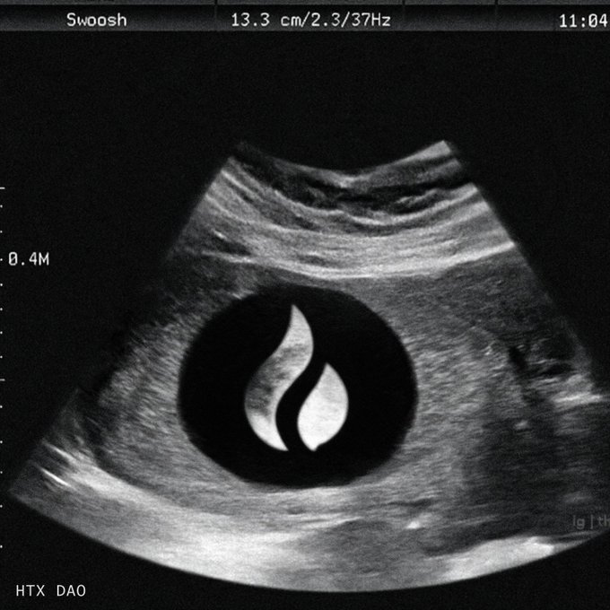 Ultrasound image with the HTX DAO flame logo overlaid in the center, showing a fetus, with 'Swoosh', '13.3 cm/2.3/37Hz', and '11:04' visible at the top.