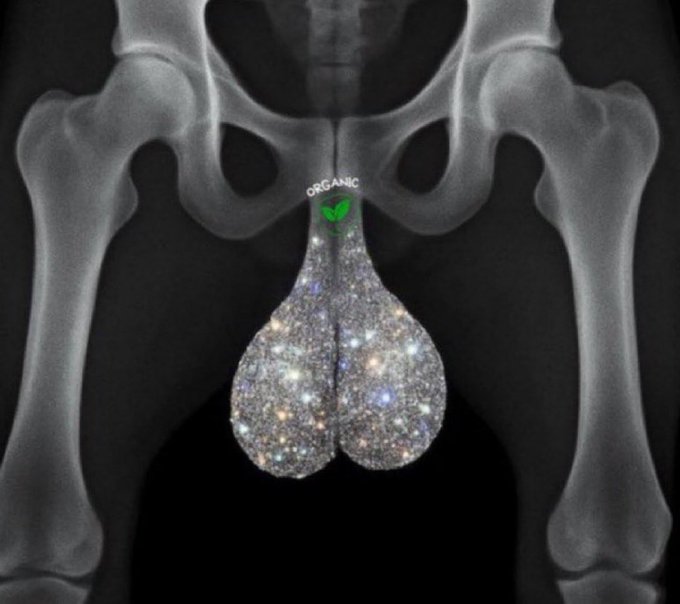 An X-ray of a human pelvis shows the testicles filled with what appears to be thousands of NFTs/jewel-toned tokens, with the word "ORGANIC" stamped at the top. The image humorously illustrates the post's joke about long-term NFT holders being left with a useless, glittering mass where their valuable "bags" should be—implying their investments have become worthless junk they're stuck carrying around.