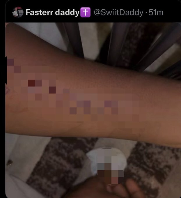 The user wants a caption describing the image based on the provided text and visual content.

1.  **Analyze the image:**
    *   The image shows a person's arm (likely an arm or leg).
    *   There is a tattoo on the skin.
    *   The tattoo is heavily pixelated/blurred out, specifically in the area where text would be. It looks like letters or symbols, but they are indistinct due to censorship/blurring.
    *   The top of the image has a Twitter/X interface overlay.
    *   Username: "Fasterr daddy" with a cross emoji.
    *   Handle: "@SwiitDaddy".
    *   Time: "51m" (posted 51 minutes ago).

2.  **Analyze the prompt's context:**
    *   The prompt provides a quote: "bro actually tattooed $ANSEM on his left hand using a razor blade mehn that's