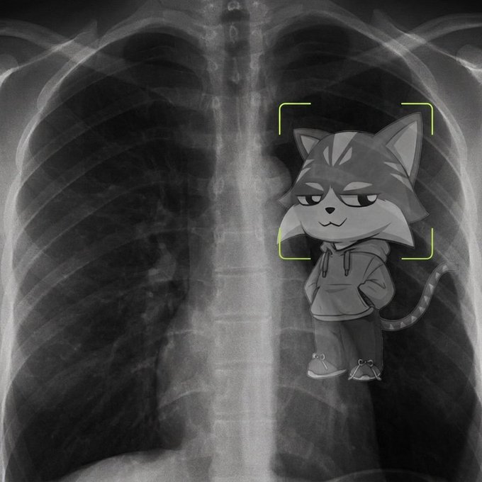 A black-and-white chest X-ray has an animated cartoon cat wearing a hoodie superimposed over the right side, framed by a yellow scanning reticle.