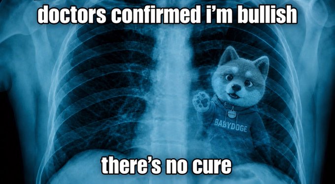An X-ray image showing BabyDoge (a Shiba Inu mascot character) overlaid on a chest X-ray with text reading "doctors confirmed I'm bullish" at the top and "there's no cure" at the bottom. The meme humorously aligns with the post's message by joking that the bullish enthusiasm for BabyDoge is an incurable condition.