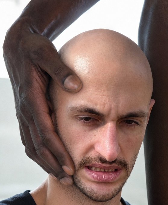 A dark-skinned hand cradles the head of a bald, bearded man whose expression conveys a mix of vulnerability and quiet intensity. The intimate contrast between the two figures creates a striking visual narrative about connection, identity, and human touch.