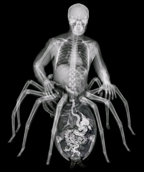 An X-ray reveals a striking human-spider hybrid, blending a skeletal human torso and skull with spider legs and internal organs, visually matching a creature reminiscent of Marvel's Spider-Man's Spider-Man symbiote, Spider-Carnage, or another similar chimeric being.