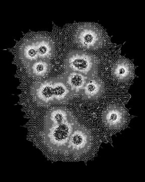 A black and white image showing several glowing, halo-like circular forms scattered across a textured, noise-filled background, resembling cosmic or microscopic structures.