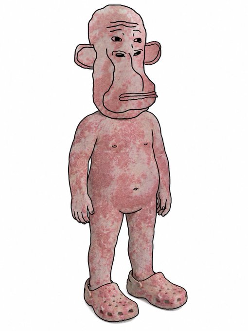 This artwork, titled "RASH ART," is a fan art piece by @GhostintheWiFi depicting a Wojak character styled as a Bored Ape Yacht Club NFT with a rash.