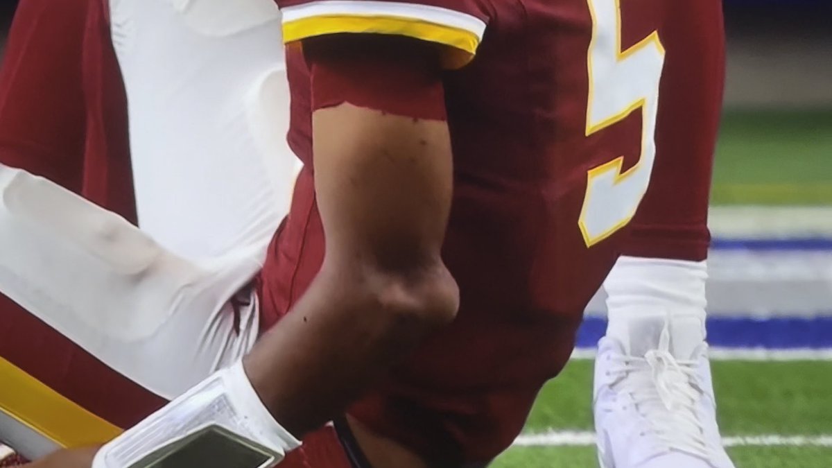 A close-up shot shows the elbow of a Washington Commanders player wearing jersey number 5, consistent with quarterback Jayden Daniels, during a football game. The angle focuses on the arm area where the injury occurred, capturing the moment on the field.