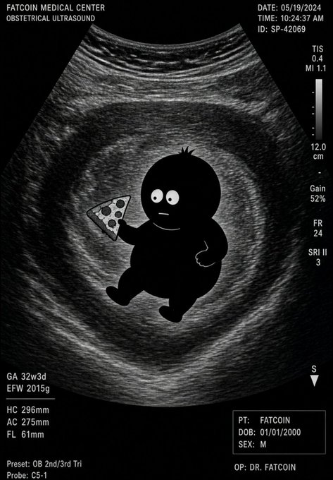 A humorous obstetric ultrasound from "FATCOIN MEDICAL CENTER" (dated 05/19/2024, patient ID SP-42069, 32w3d gestation) features a cartoon fetus illustration holding a slice of pepperoni pizza, playing on the post's joke about the baby being a "fatass in the womb" requesting extra cheese before starting $LLY meds.
