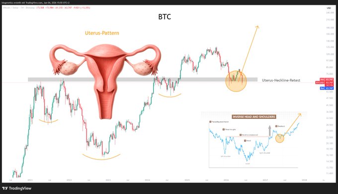The image shows a computer monitor displaying a graph with an analysis of Bitcoin trends, which appear to be similar to those of the cervix pattern. The monitor also features an illustration of a female reproductive system showing a red "BTC" symbol positioned above the cervix on top of two blue "UTERUS-PATTERN". This graphic is used as part of a post discussing the Bitcoin market trends and its relation to the cervix pattern, creating a visual metaphor.