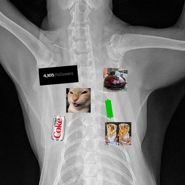 A grayscale chest X-ray with several memes and stickers overlaid, including a "4,105 Followers" text, a Diet Coke can, a cat licking its lips, a sports car, a green rectangle, and an image of someone holding a sandwich.