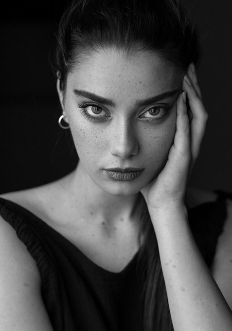 A black and white close-up portrait of a woman with freckles and striking eyes, resting her face against her hand.
