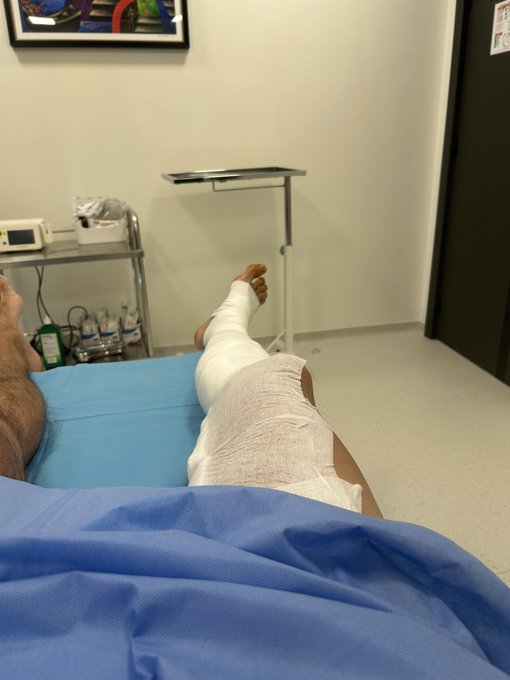 A first-person view from a hospital bed shows a patient with a bandaged leg and foot resting on a blue pillow, with medical equipment visible in the background.