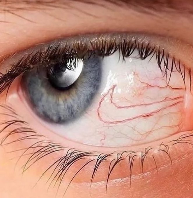 Extreme close-up of a blue human eye with visible red blood vessels in the sclera.