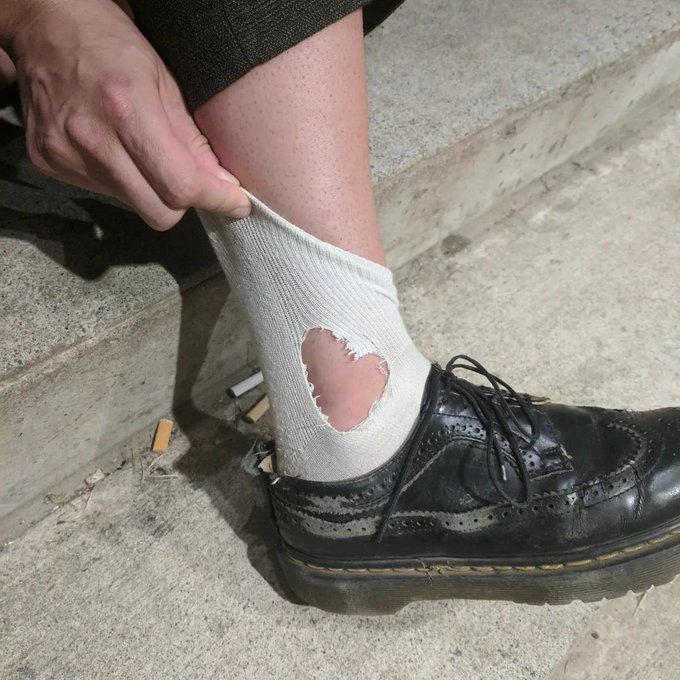A close-up photo of a person's hand pulling up a white sock to reveal a large worn hole exposing the skin, paired with a scuffed black leather dress shoe on concrete steps.