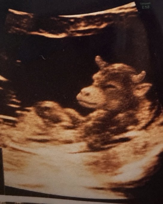 A sepia-toned ultrasound image shows a baby goat (kid) curled up inside the womb.