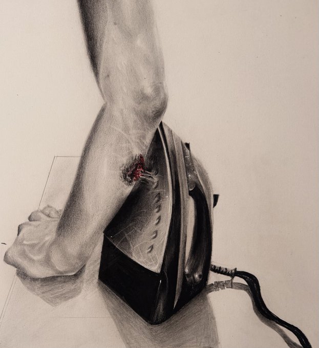 A black-and-white pencil drawing depicting a bare leg and foot being burned by a hot clothing iron, with a blister on the calf.