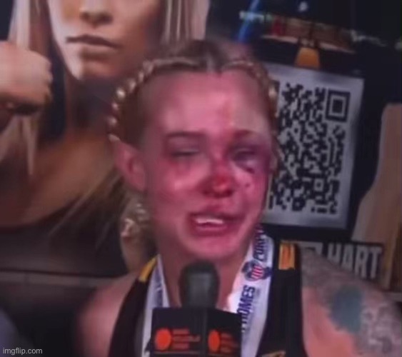 This image shows a woman with a bruised face being interviewed, with the accompanying text discussing a dramatic reduction in "skip rate" from over 30% to less than 1% during peak demand, implying a significant improvement in system performance after debugging.