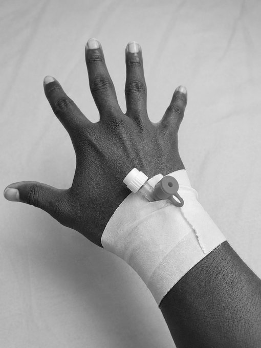 A black-and-white photo shows a dark-skinned hand with light-colored fingernails held up, with a white bandage and IV port wrapped around the wrist.