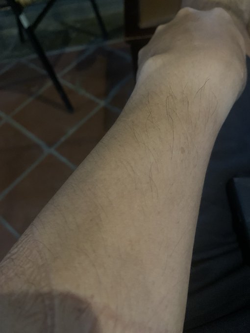 A close-up photo of a person's arm showing dark body hair on light skin, with a tiled floor visible in the background.