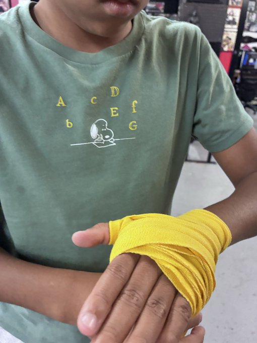 A child wearing a green t-shirt with musical letters (A, C, D, E, F, G, b) printed on it, with their hand wrapped in a yellow cloth bandage.