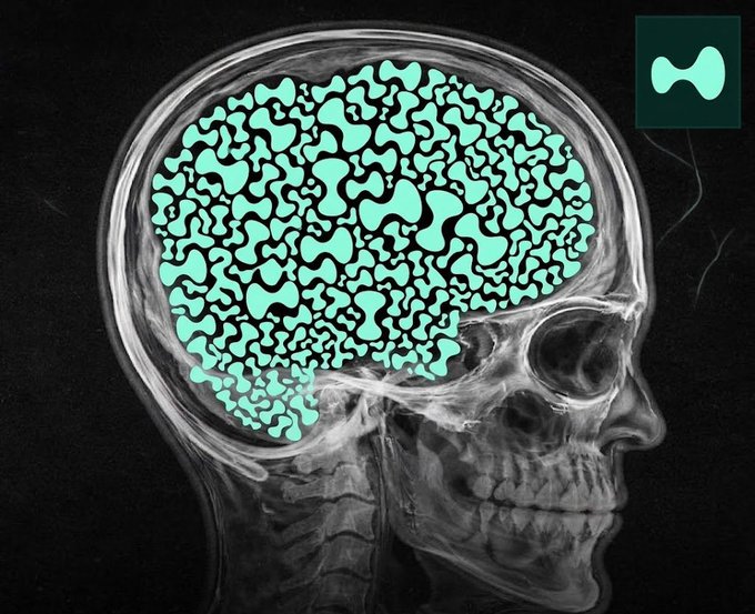 A sagittal skull X-ray with the brain region highlighted in teal, featuring a small inset logo in the top-right corner showing Hyperliquid's distinctive "H" emblem—symbolizing the "HyperEVM season" on Hyperliquid.