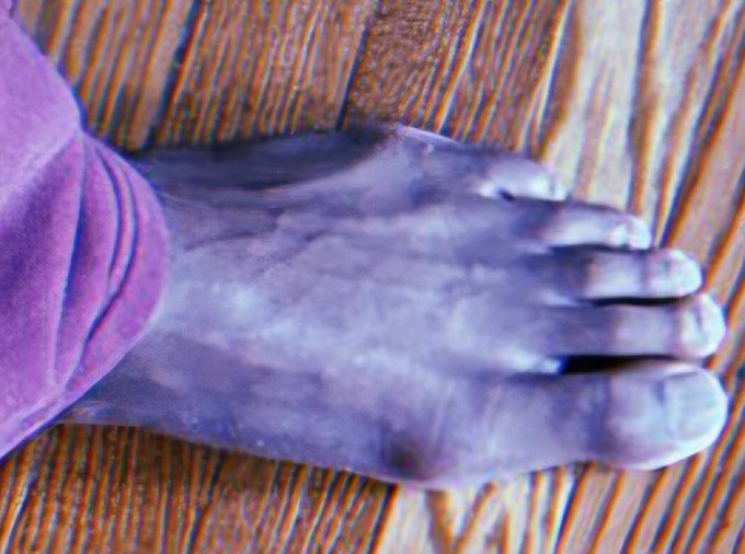 A close-up photo of a foot and lower leg covered in purple powder, resting on a wooden plank surface.